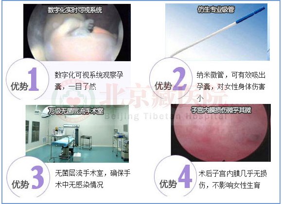 微管可视无痛人流术-安全、无痛、保宫