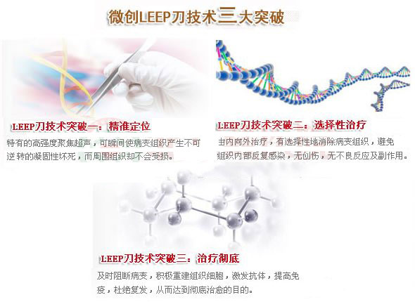 超高频微创LEEP刀技术 让您远离糜烂之忧